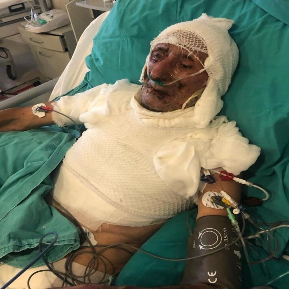 Ateşe Verdi Kastamonu (4)