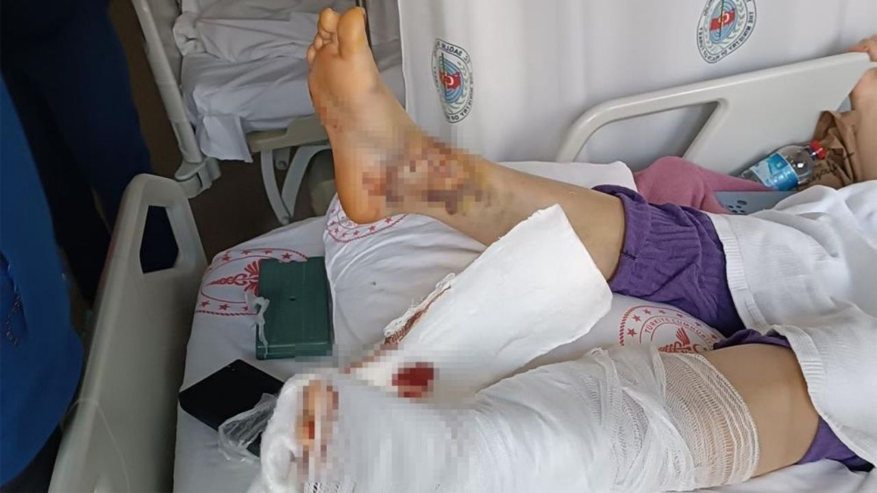 Çocuklarının Gözü Önünde Dehşeti Yaşattı Saldırgan Koca Tutuklandı (3)