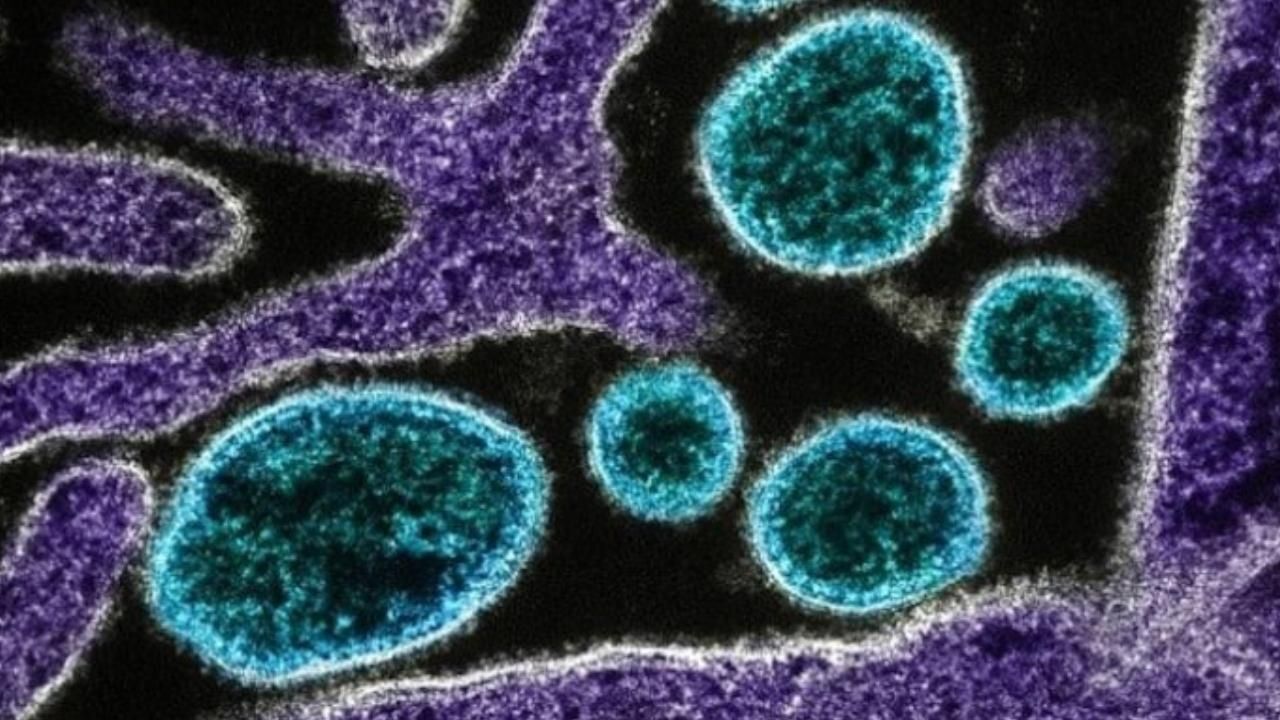 Hantavirüs Nedir, Nasıl Bulaşır Hantavirüs Belirtileri Neler (1)