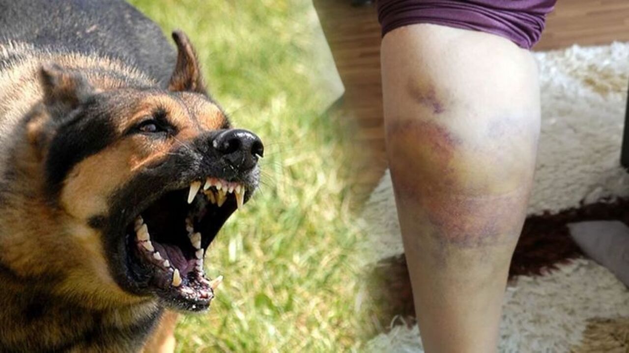 Köpek Isırdı 87