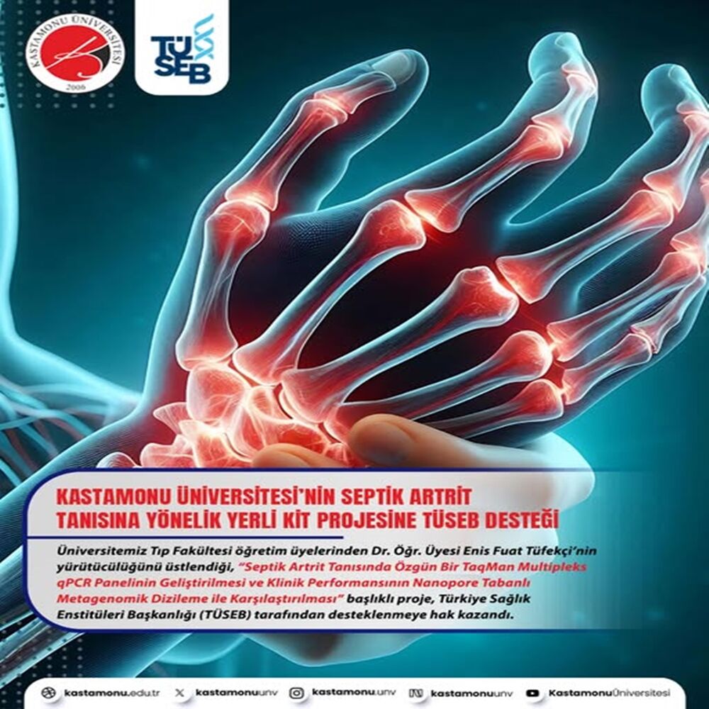 Üniversitemizin Septik Artrit Tanısına Yönelik Yerli Tanı Kiti (2)