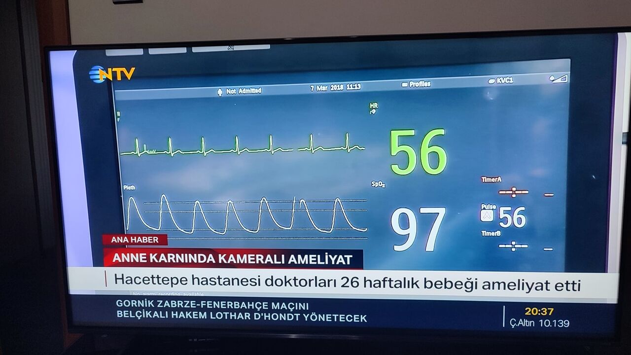 Anne Karnında Ameliyat Türkiye De Ilk (1)-1