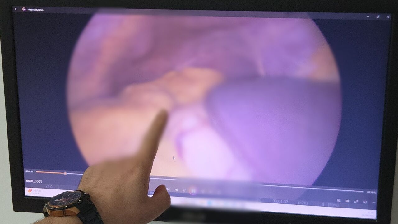 Doktorları Şaşkına Çeviren Olay Tüm Organları Ters Çıktı